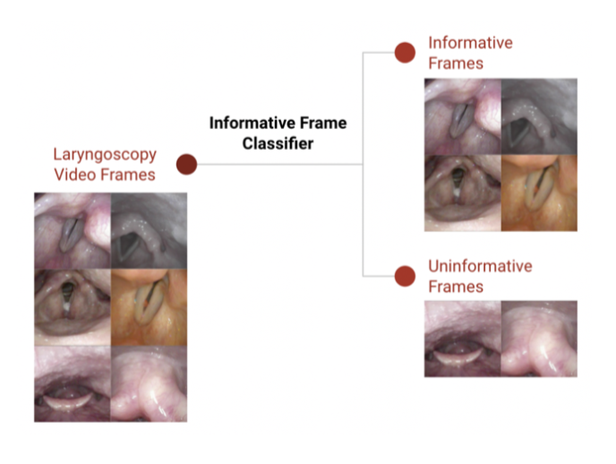 A flow chart showing Laryngoscopy Video frames on the left flowing into two distinct images of Informative Frames vs Uninformative Frames on the right.